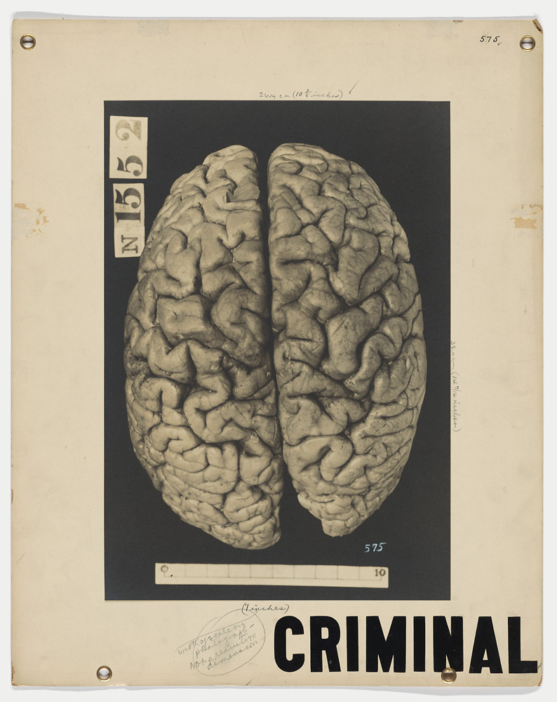 criminal brain