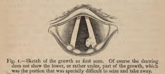 Figure 1 from Mackenzie