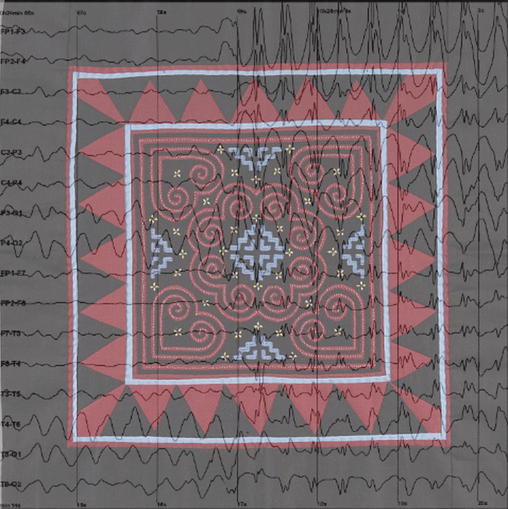 Image of a red, black, and blue appliqued piece of embroidery by a Hmong artist is overlaid with scrawled recordings of a brain wave reading from a child with epilepsy
