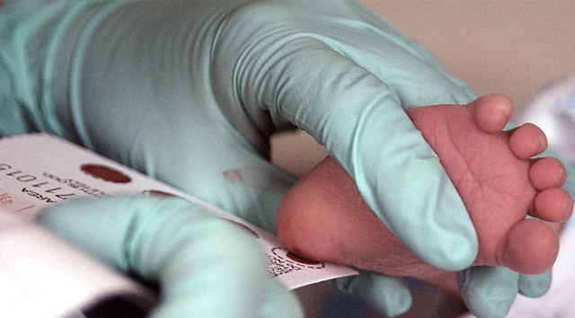 Image of a gloved hand holding a newborn infant's foot to obtain blood sample for a newborn screening blood test.