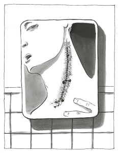 Image from David Small's graphic memoir Stitches of a close up scar on a boy's neck with many stithces